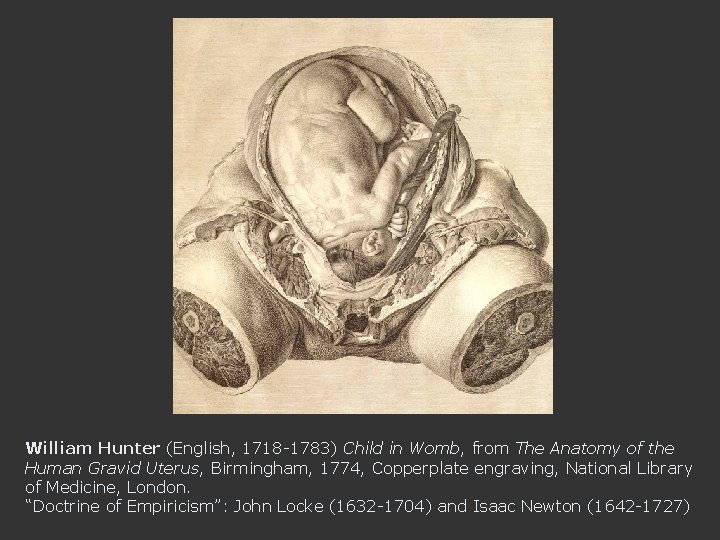 William Hunter (English, 1718 -1783) Child in Womb, from The Anatomy of the Human
