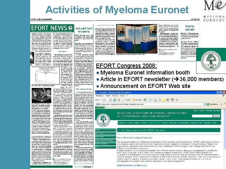 Activities of Myeloma Euronet EFORT Congress 2008: ● Myeloma Euronet information booth ● Article
