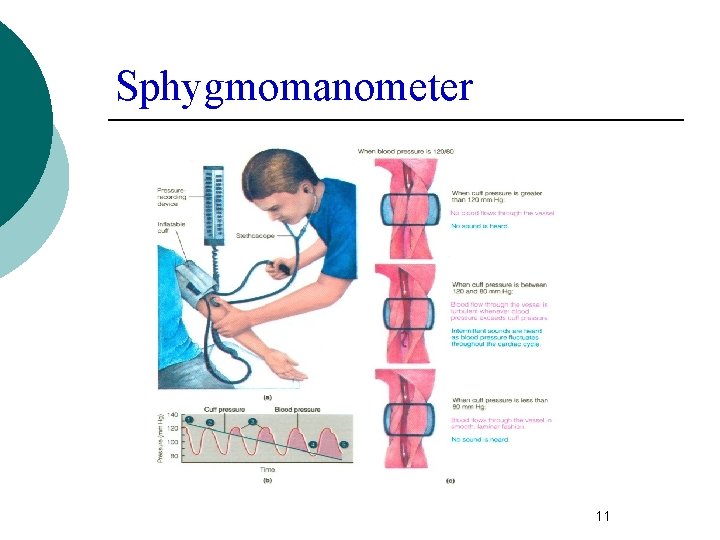 Sphygmomanometer 11 
