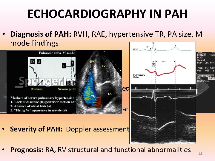 ECHOCARDIOGRAPHY IN PAH • Diagnosis of PAH: RVH, RAE, hypertensive TR, PA size, M ECHOCARDIOGRAPHY IN PAH • Diagnosis of PAH: RVH, RAE, hypertensive TR, PA size, M