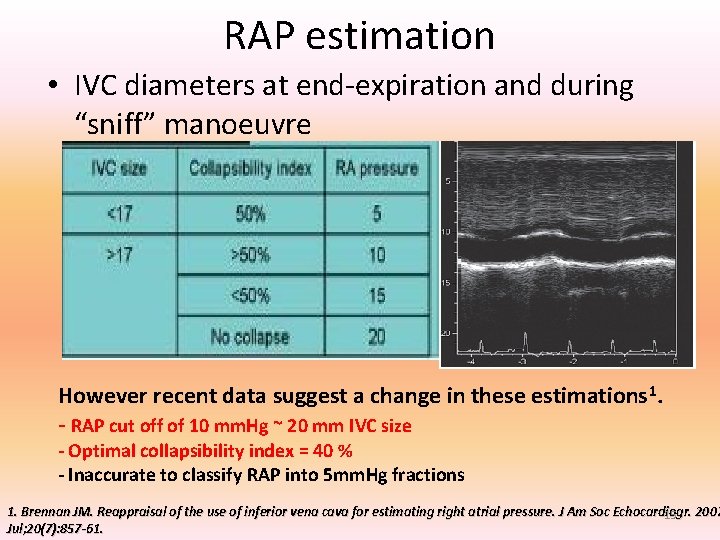 RAP estimation • IVC diameters at end-expiration and during “sniff” manoeuvre However recent data RAP estimation • IVC diameters at end-expiration and during “sniff” manoeuvre However recent data