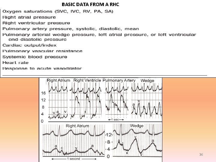 BASIC DATA FROM A RHC 36 BASIC DATA FROM A RHC 36