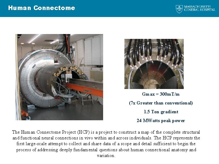 Human Connectome Gmax = 300 m. T/m (7 x Greater than conventional) 1. 5