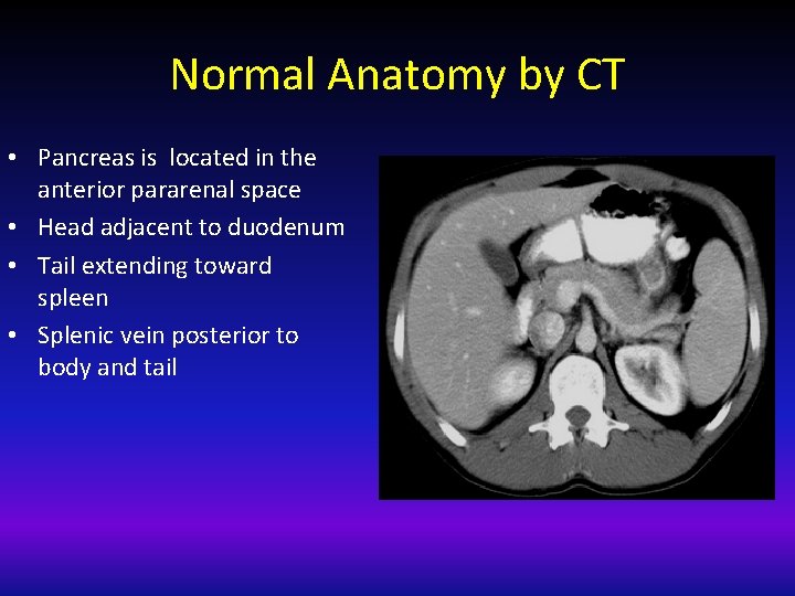 Normal Anatomy by CT • Pancreas is located in the anterior pararenal space •
