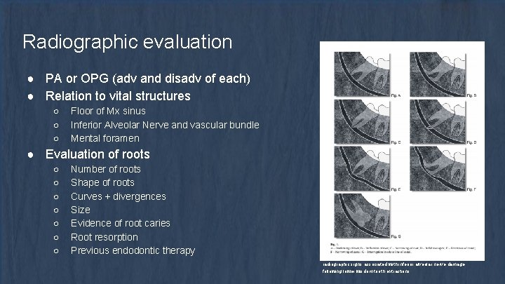 Radiographic evaluation ● PA or OPG (adv and disadv of each) ● Relation to