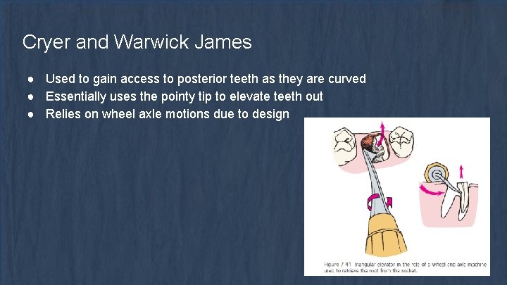 Cryer and Warwick James ● Used to gain access to posterior teeth as they