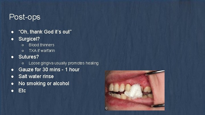 Post-ops ● “Oh, thank God it’s out” ● Surgicel? ○ ○ Blood thinners TXA