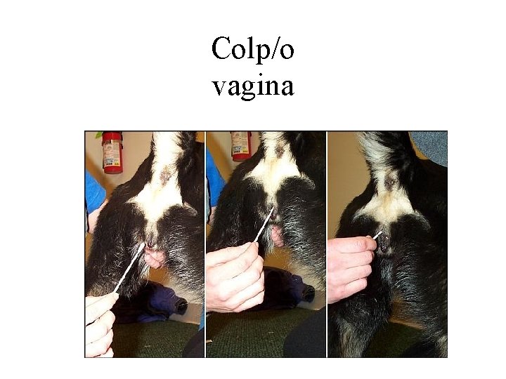 Colp/o vagina 