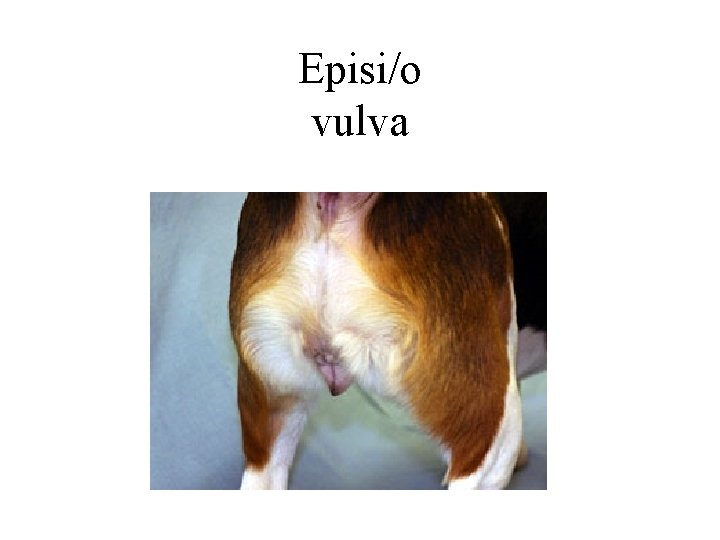 Episi/o vulva 