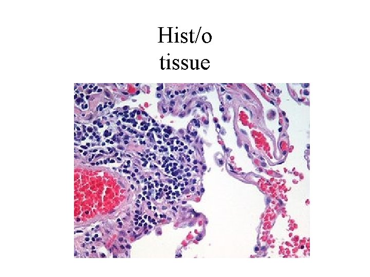 Hist/o tissue 
