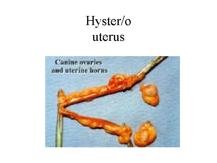 Hyster/o uterus 