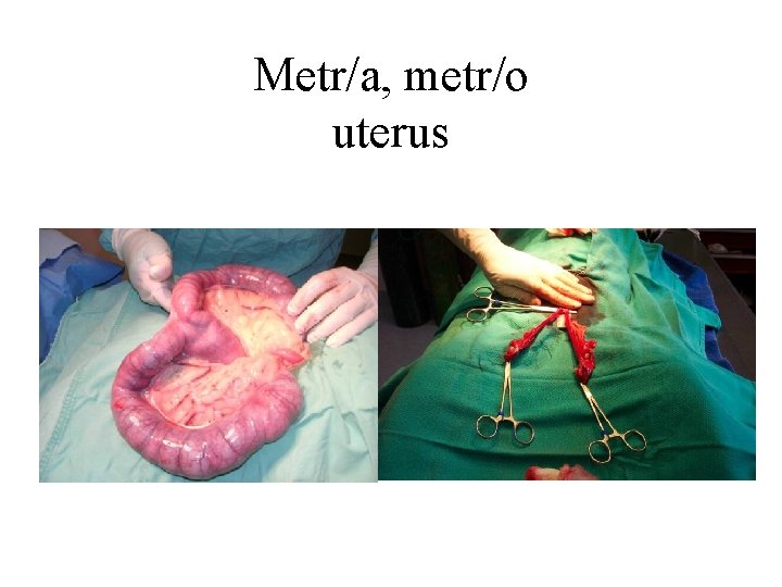 Metr/a, metr/o uterus 