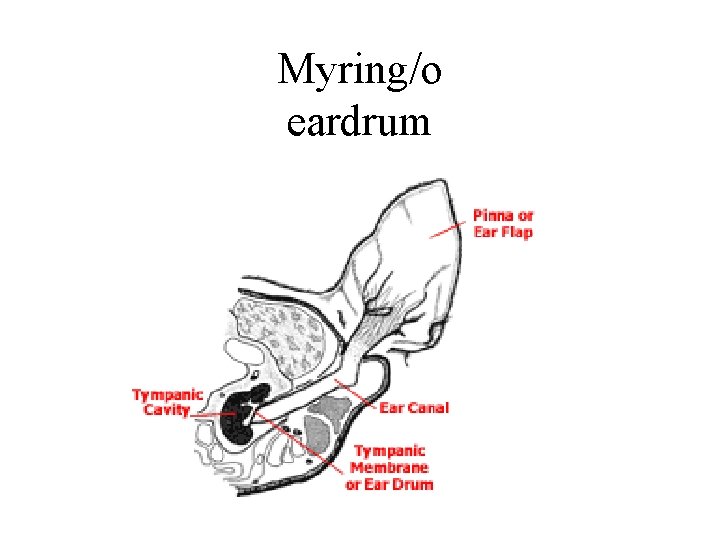 Myring/o eardrum 
