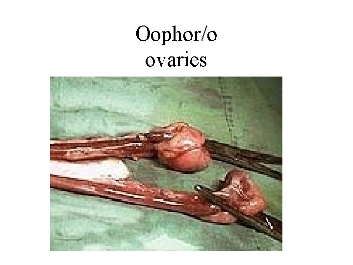 Oophor/o ovaries 