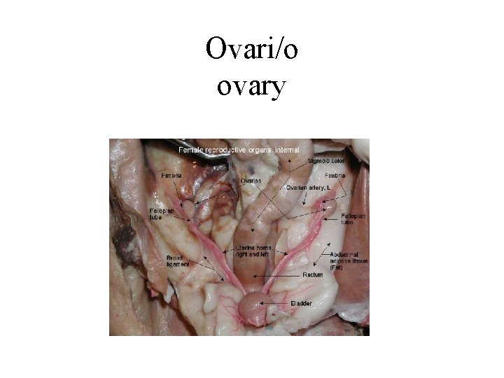 Ovari/o ovary 