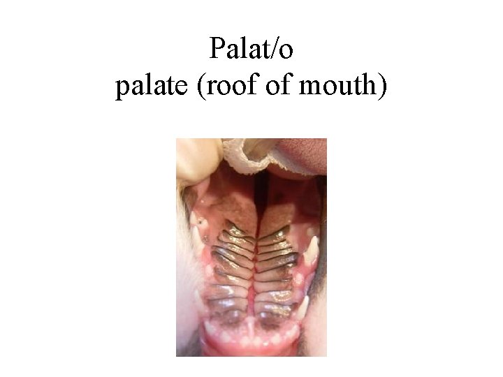 Palat/o palate (roof of mouth) 