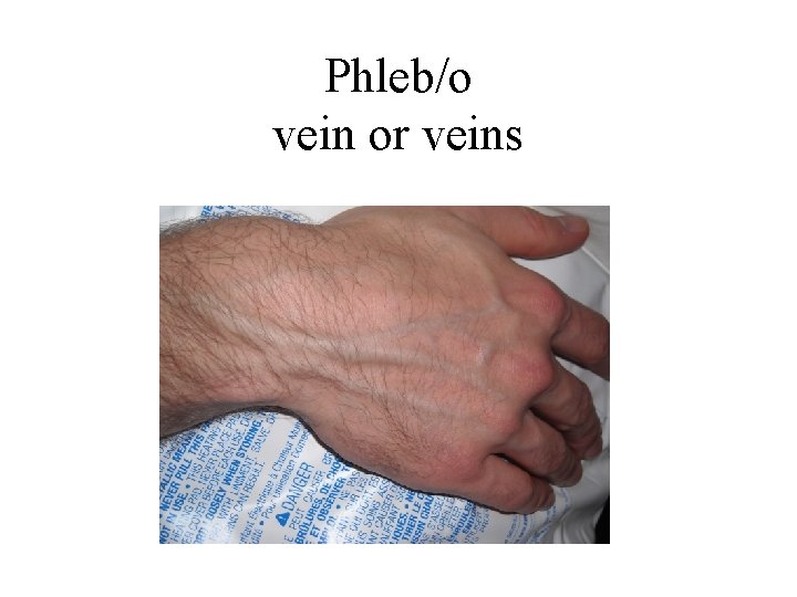 Phleb/o vein or veins 