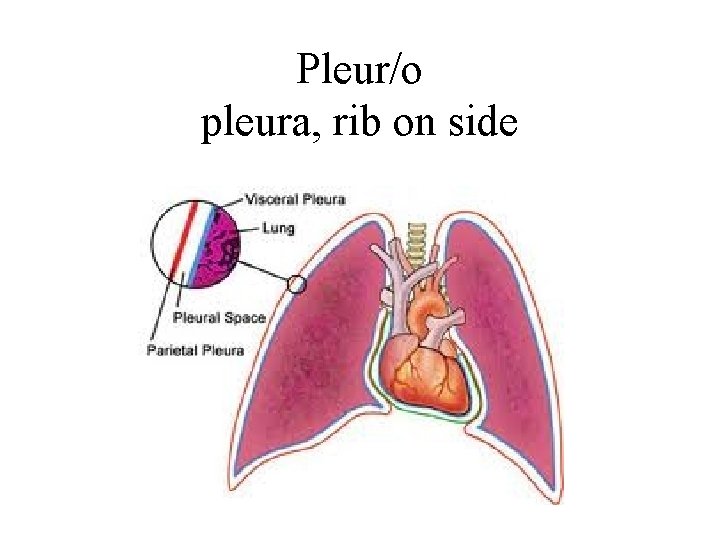 Pleur/o pleura, rib on side 
