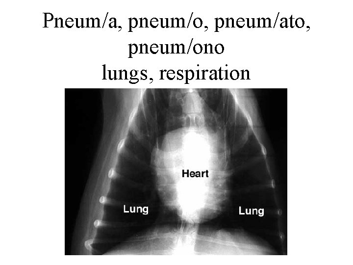 Pneum/a, pneum/o, pneum/ato, pneum/ono lungs, respiration 