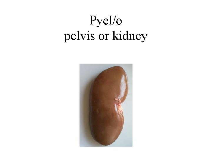 Pyel/o pelvis or kidney 