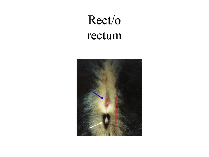 Rect/o rectum 