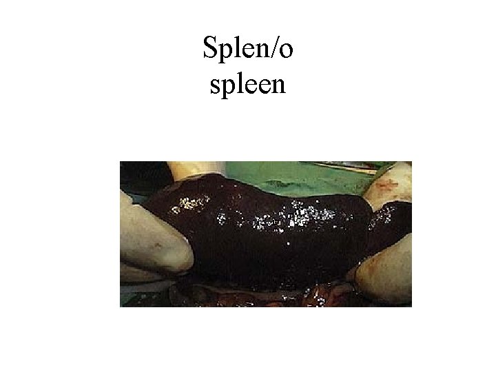 Splen/o spleen 
