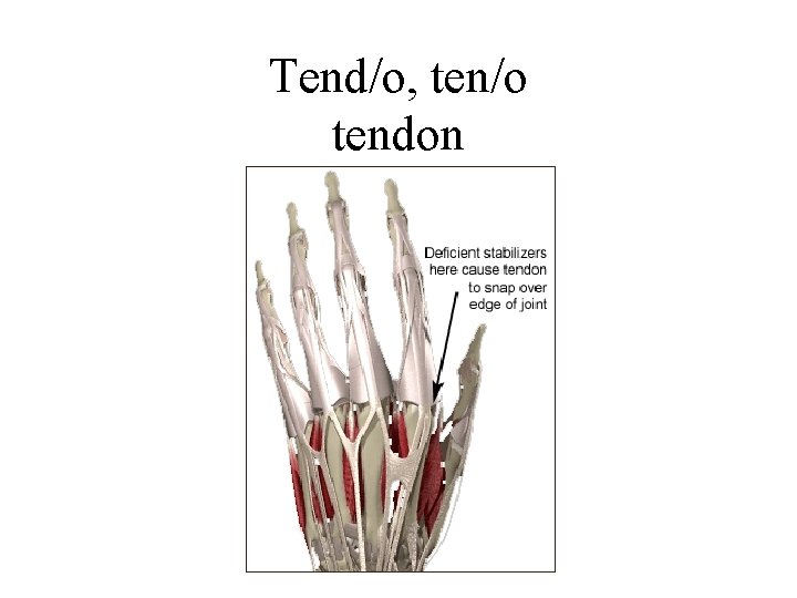 Tend/o, ten/o tendon 