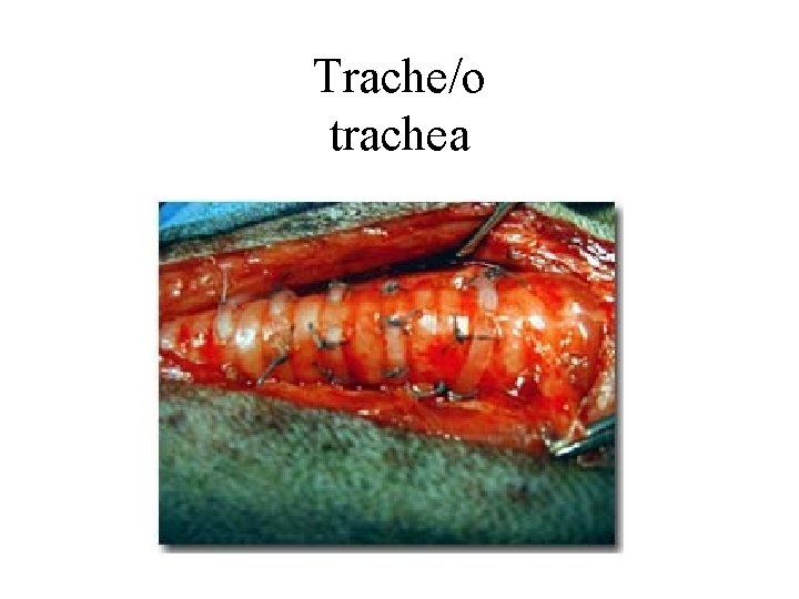 Trache/o trachea 