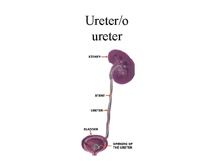 Ureter/o ureter 