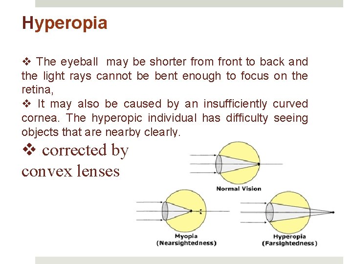 hyperopia és myopia