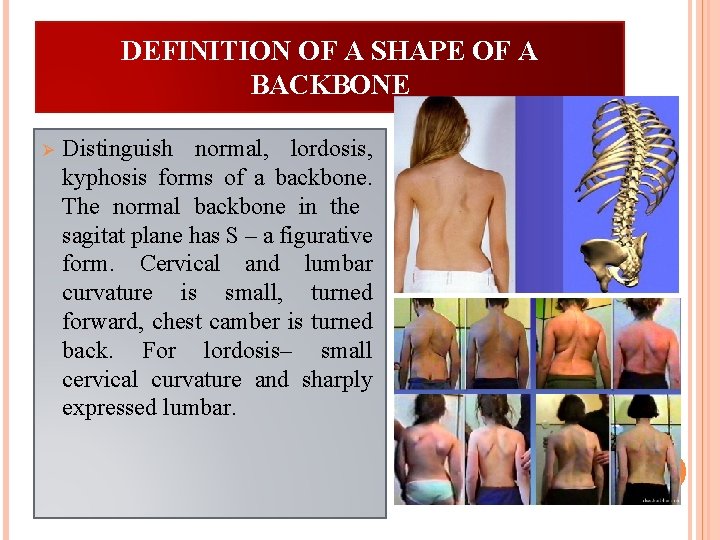 DEFINITION OF A SHAPE OF A BACKBONE Ø Distinguish normal, lordosis, kyphosis forms of