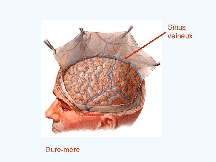 Sinus veineux Dure-mère 