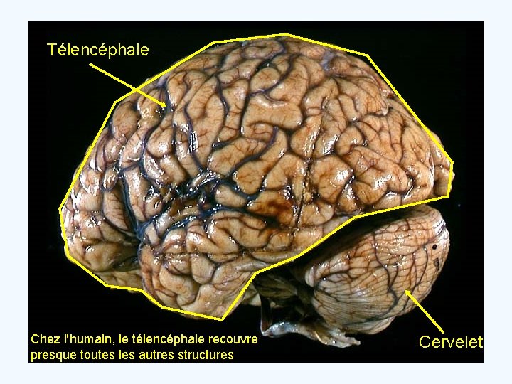 Télencéphale Chez l'humain, le télencéphale recouvre presque toutes les autres structures Cervelet 