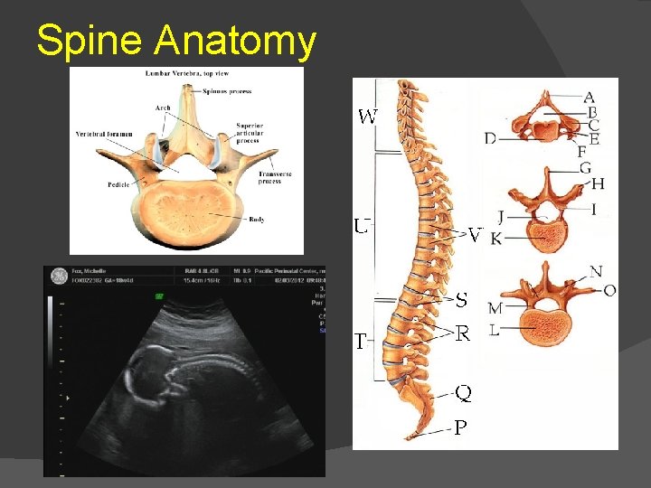 Spine Anatomy 