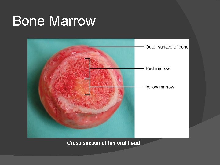 Bone Marrow Cross section of femoral head 