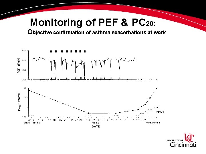 Monitoring of PEF & PC 20: Objective confirmation of asthma exacerbations at work Cartier Monitoring of PEF & PC 20: Objective confirmation of asthma exacerbations at work Cartier