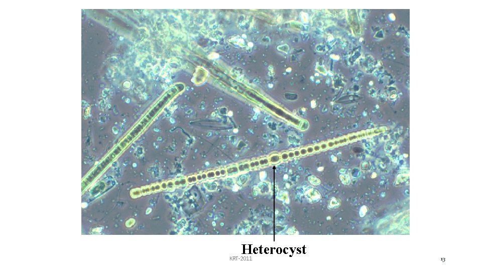 Heterocyst KRT-2011 13 