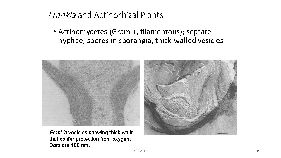 Frankia and Actinorhizal Plants • Actinomycetes (Gram +, filamentous); septate hyphae; spores in sporangia;