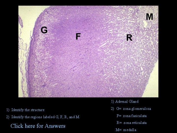 1) Adrenal Gland 1) Identify the structure 2) Identify the regions labeled G, F,