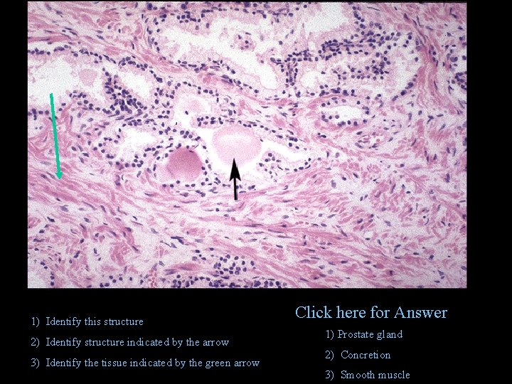 1) Identify this structure 2) Identify structure indicated by the arrow 3) Identify the