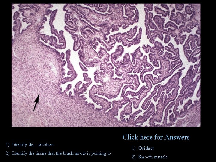 Click here for Answers 1) Identify this structure. 2) Identify the tissue that the