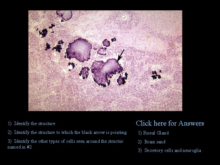 1) Identify the structure Click here for Answers 2) Identify the structure to which