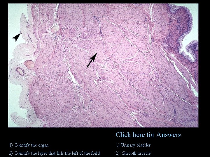 Click here for Answers 1) Identify the organ 1) Urinary bladder 2) Identify the