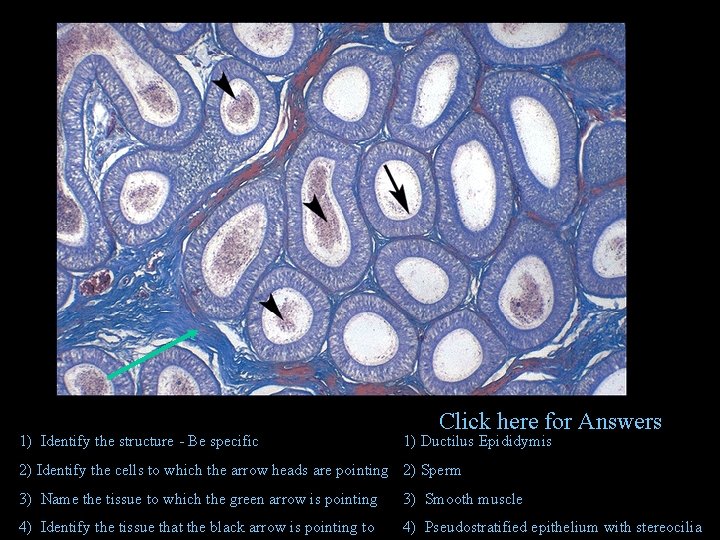 1) Identify the structure - Be specific Click here for Answers 1) Ductilus Epididymis