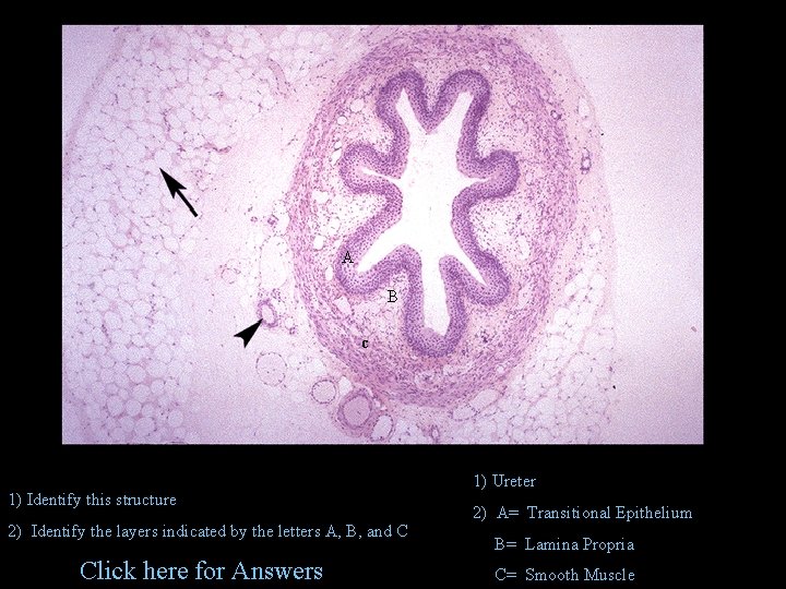 A B c 1) Identify this structure 2) Identify the layers indicated by the