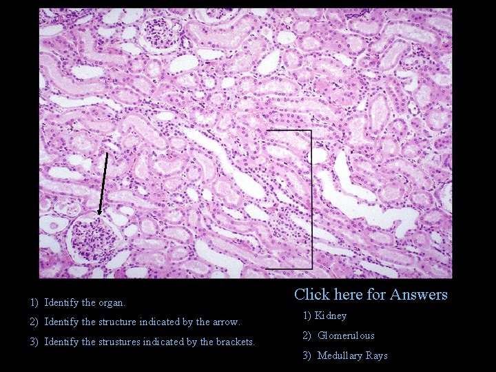 1) Identify the organ. 2) Identify the structure indicated by the arrow. 3) Identify