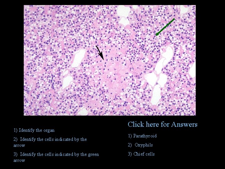 1) Identify the organ 2) Identify the cells indicated by the arrow 3) Identify