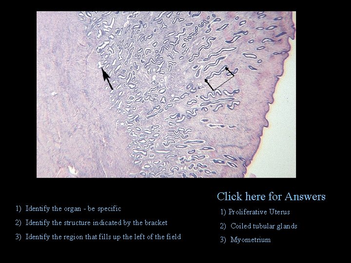 Click here for Answers 1) Identify the organ - be specific 1) Proliferative Uterus