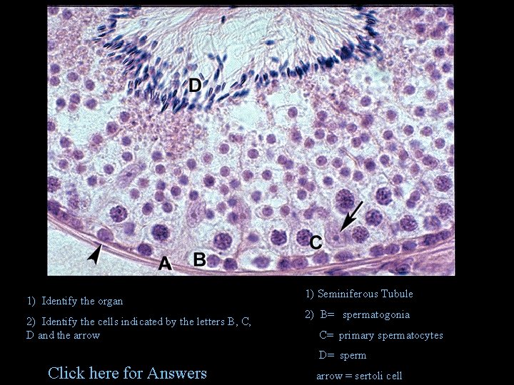 # 1 -3 #4 1) Identify the organ 2) Identify the cells indicated by