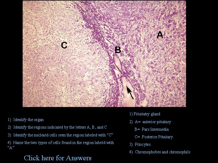 1) Pituitatry gland 1) Identify the organ 2) A= anterior pituitary 2) Identify the